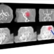 Image that similar to X-ray of the brain and skull