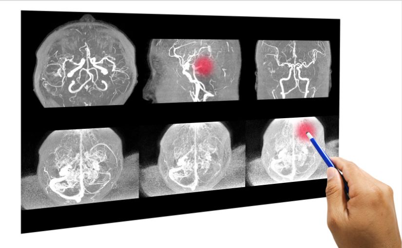 Image that similar to X-ray of the brain and skull