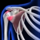Illustration of the shoulder joint, highlighting its structure and components for anatomical reference.